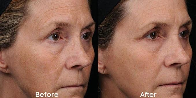 Replere - Repair & Replenish All Natural Moisturizing Night Crรจme - Reduce wrinkles, Dark Spots & Fine lines -1.7 OZ