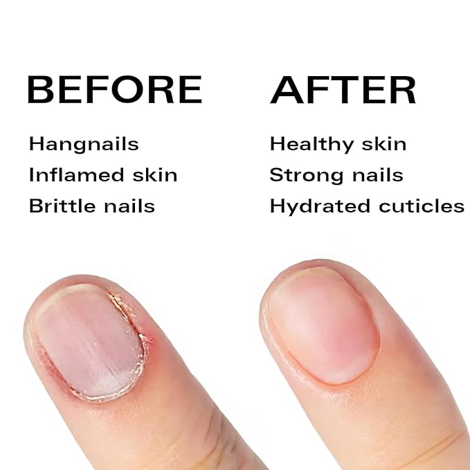 Beauty Power Nail Oil Cuticle Pen - Watermelon - Nail Strengthener & Growth Serum with Vitamin A, D, E, B5, Grapeseed & Natural Oils - Repair for Brittle, Peeling, Thin Nails - Twist Brush Pen