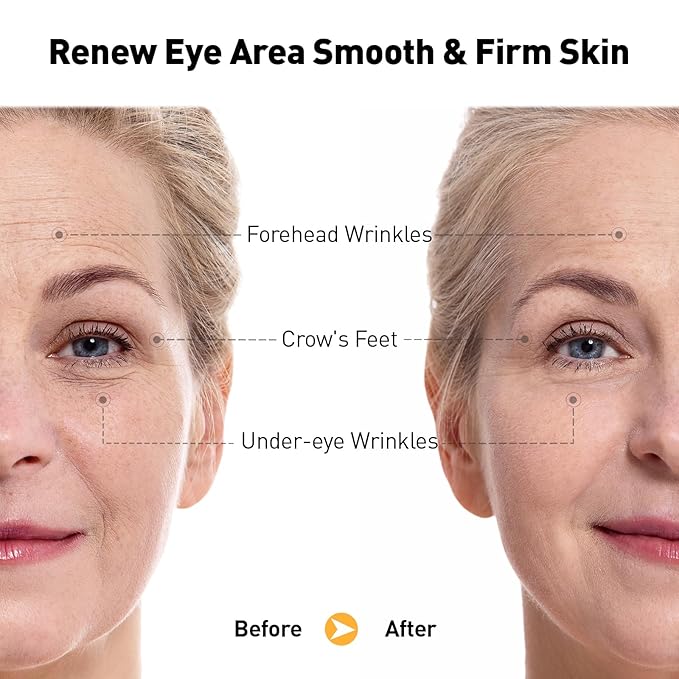 Retinol Eye Cream for Anti-Aging & Wrinkles – Firming, Hydrating & Repairing Eye Serum with Niacinamide, Hyaluronic Acid, Vitamin E & Bifida Ferment Lysate, 0.7 Fl Oz (Pack of 2)