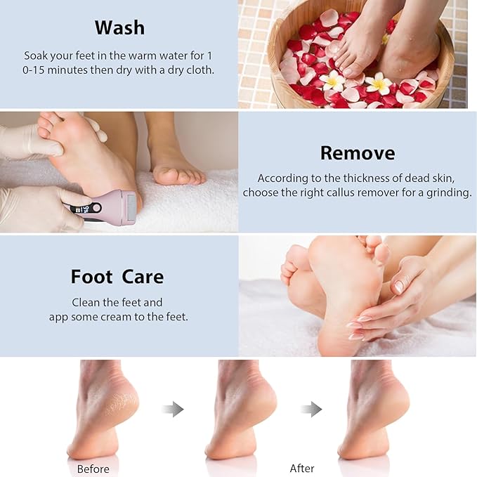 AdamPark Electric Callus Remover for Feet, Rechargeable Portable Electronic Foot Callus Remover 2-in-1 Wet/Dry Foot Scrubber Electric Toot File for Hard Cracked Dry Dead Skin(Pink)
