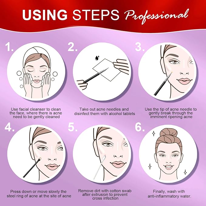 Teenitor Pimple Extractor Tool Comedone Extractor Acne Tool Blackhead Removal Tool 2-in-1 Pimple Popper Tool for Face and Nose Black