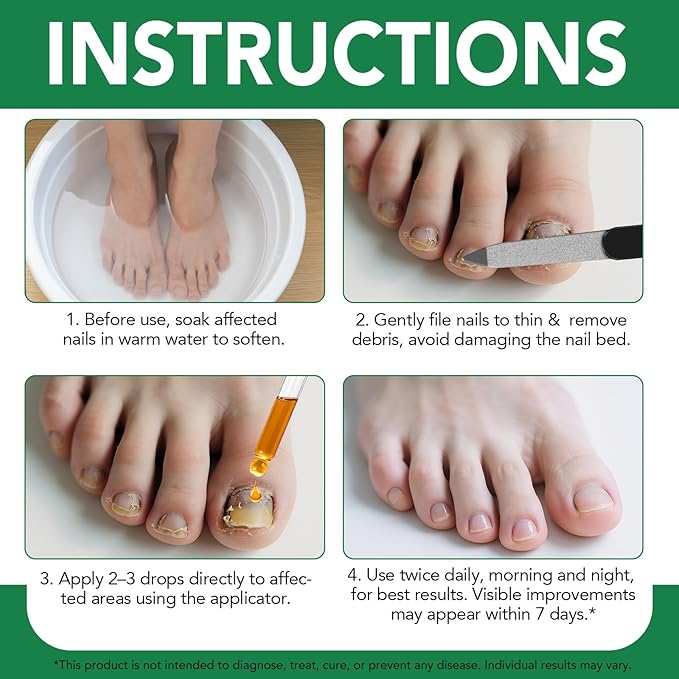 Toenail Treatment with 25% Undecylenic Acid, Nail Renewal, Promotes Nails Health,Enrich Jojoba Oil and Vitamin E Nourish Nail & Skin,Safe & Gentle Repairing Damaged Nails