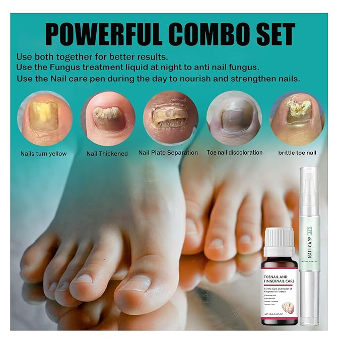 Nail Fungus Treatment,7 Days Extra Strength 2 Bottles Solution Repair and Renew Discolored Damaged Nails and Thick Toenails,1 Nail Care Pen for Nails Moisturize and Nourish,7 Days to Healthy Nails
