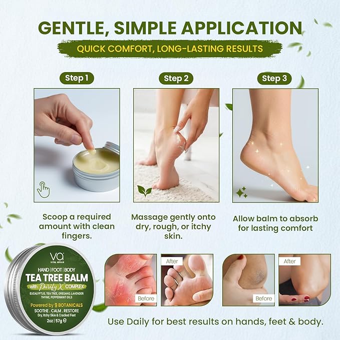 VITAL AFFAIR Tea Tree Oil Balm – Soothing Care for Rashes, Athlete’s Foot, Jock Itch, Bug Bites, Folliculitis, Cracked Feet, Dry, Flaky, Irritated Skin – For All Ages & Sensitive Skin - 2 oz