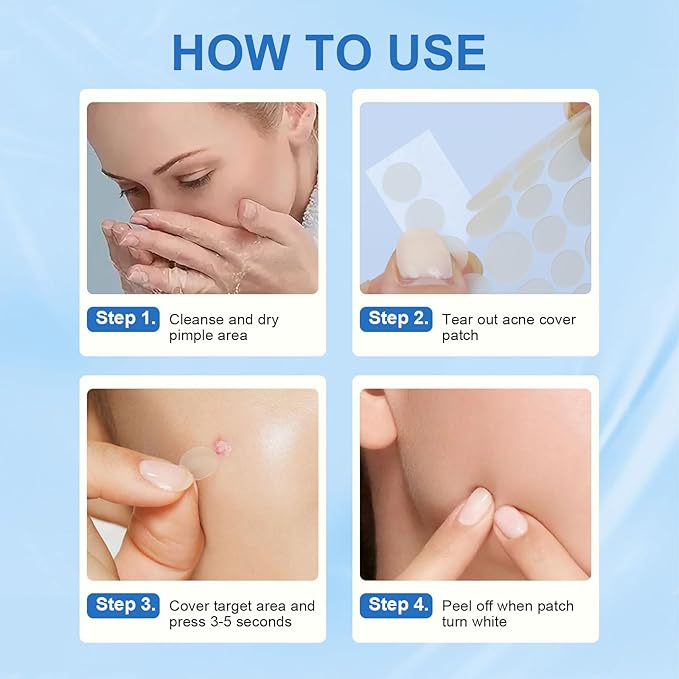 Amouy Acne Pimple Patch- 2 Sizes 612 Dots Thin & Thick Hydrocolloid Patches for Face with Witch Hazel, Tea Tree & Calendula Oil, Extra Adhesion Pimple Patches for Face Zit Patch Acne Dots