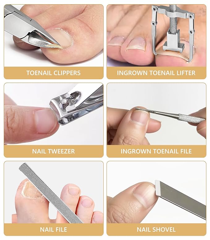 Ingrown Toenail Corrector Set with Correction Strips, Ingrown Toenail Removal Kit, Professional Ingrown Toenails Pedicure Tool Set, Curved Toenails Corrector Patch