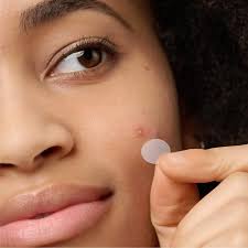 Why Pimple Patches Are a Skincare Essential in 2026