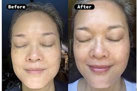 Dark Spot Corrector: The Secret to Brighter, More Even-Looking Skin