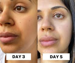 How to Repair Your Skin Barrier Fast (2025 Dermatologist-Backed Guide)