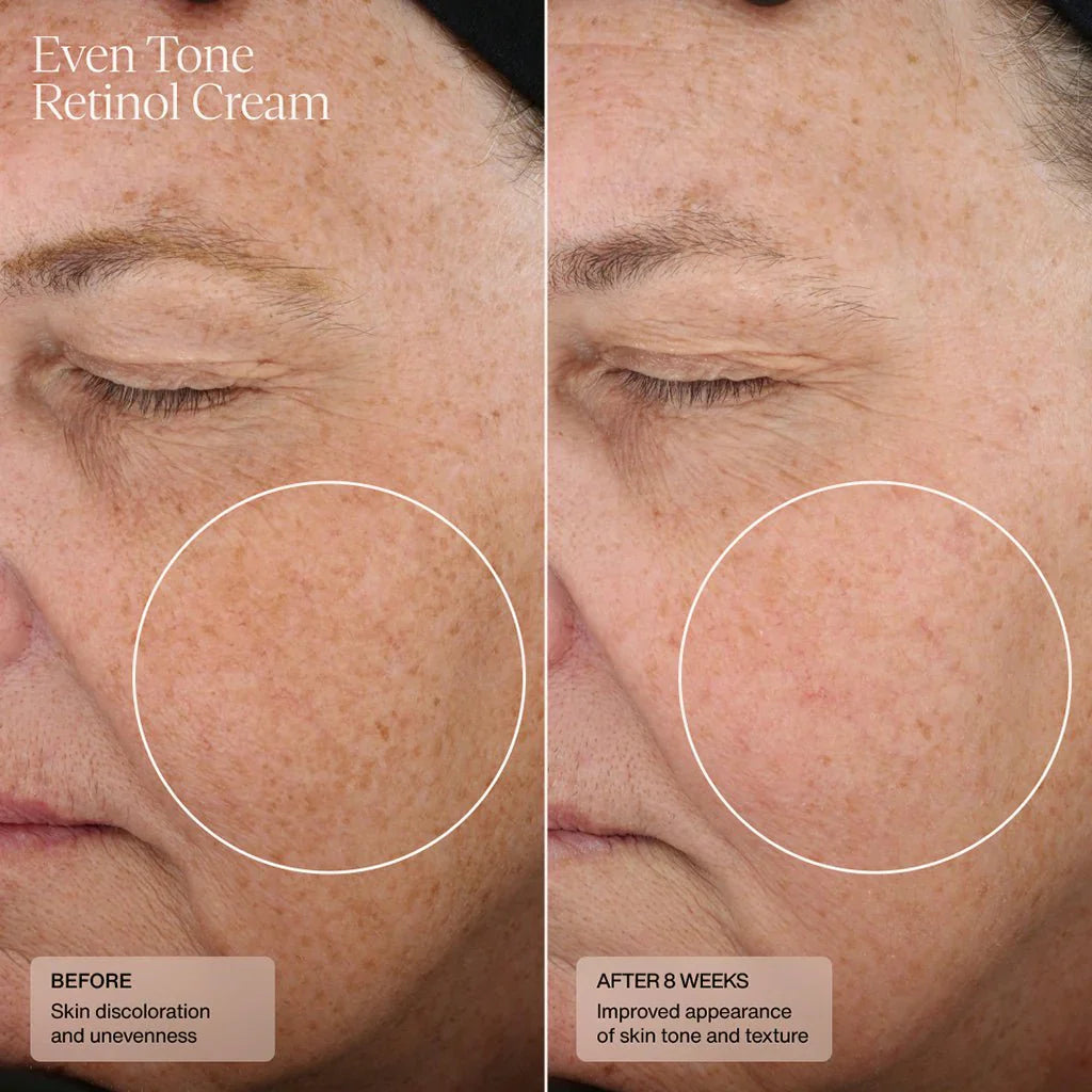 Top 7 Anti-Aging Ingredients That Actually Work (Science-Backed 2026 Guide)