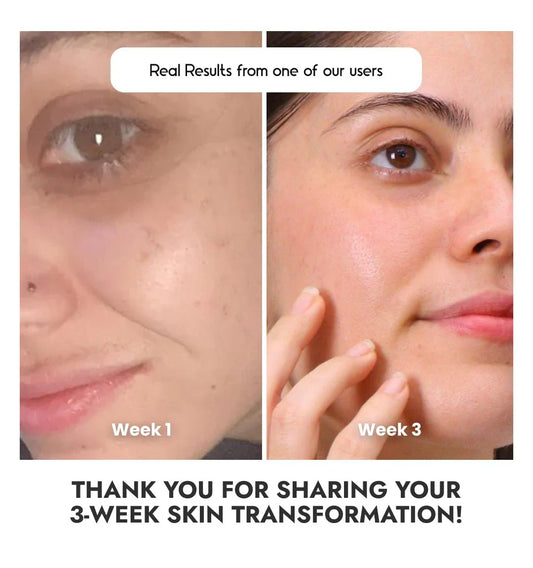 Best Vitamin C Serum for Glowing Skin in 2026 (Honest Review + Results)