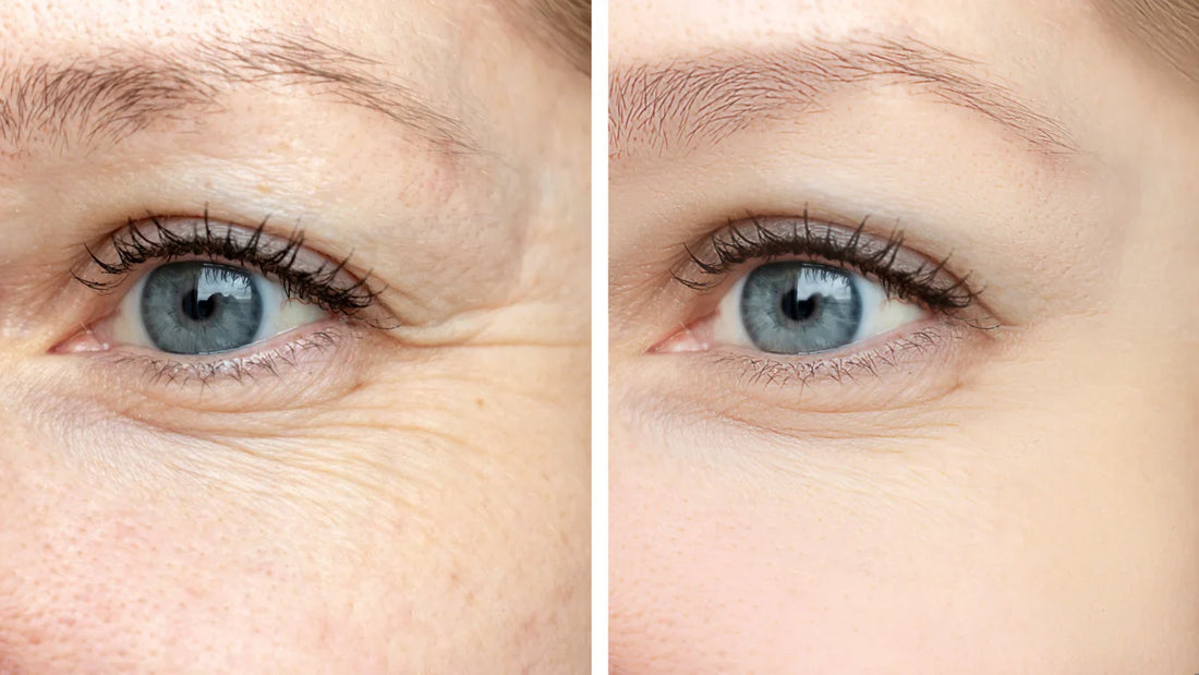 PDRN vs Retinol: Which One Is Better for Anti-Aging in 2026?