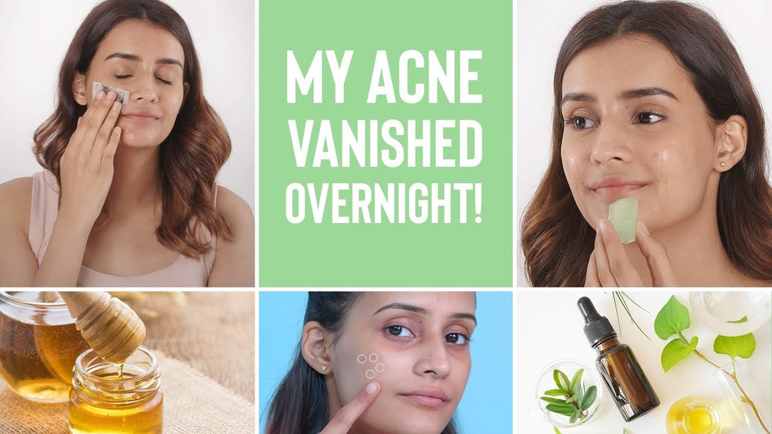 How to Get Rid of Acne Overnight (What Actually Works in 2026)
