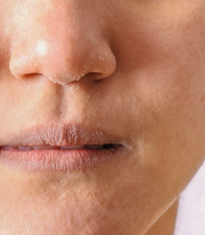 The Best Skincare Routine for Dry Skin