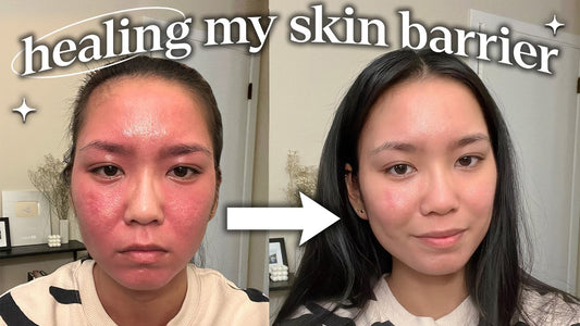 How to Repair Your Skin Barrier Fast (Step-by-Step Guide)