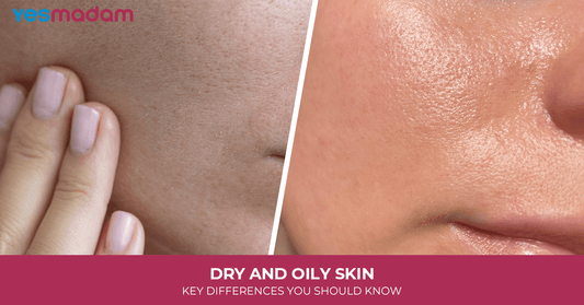 Oily But Tight? You Might Have Dehydrated Skin (Not Just Oily Skin)