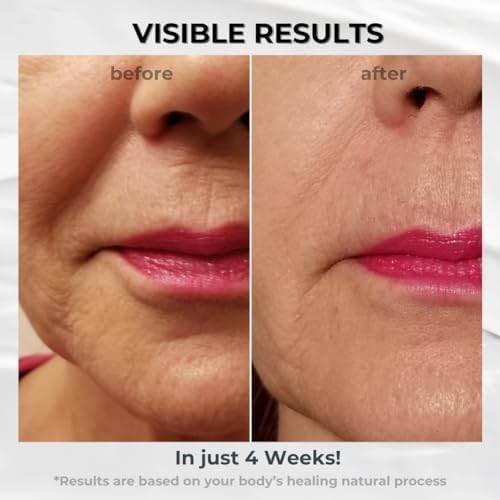 BIONOVA Anti-Aging Upper Lip Treatment with UV Chromophores - Reduce Mild to Deep Vertical Lip Lines, Wrinkles and Prevent Lipstick Bleeding (0.5 oz)
