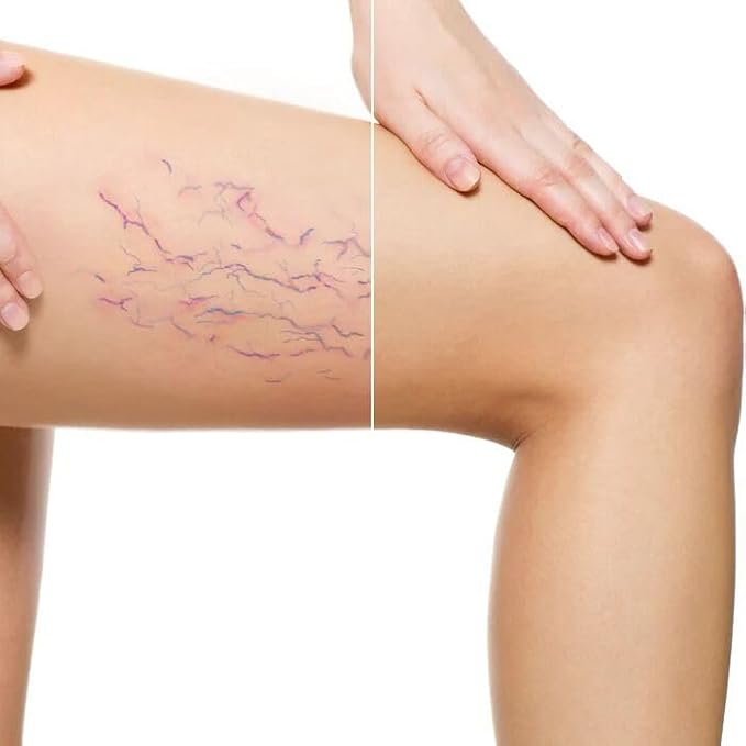 LUMINESS Airbrush Body Coverage - Tattoo Cover Up Makeup - Full Coverage Foundation for Face & Body - Water-Resistant, Long-Wear, Natural Radiant Finish, Deep Rich