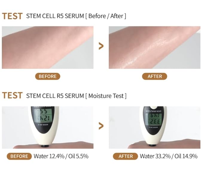 tom-tit-tot Stem Cell R5 Serum - Anti-Wrinkle Serum, 10,000ppm Human Stem Cell, Eosidin and Adenosine, Korean Premium Skin Care (50ml/1.69 fl oz)