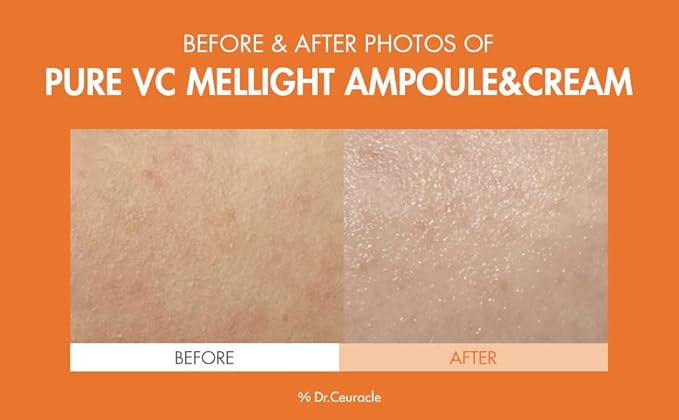 Dr.Ceuracle by leegeehaam Pure VC Mellight Ampoule - Vitamin C Serum for Face, One Week Program for Anti-oxidant, Firm, Clarify, Fade Pigmentation, Skin Radiance (1 Count (Pack of 1))