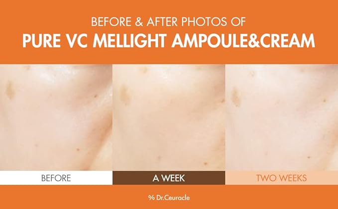 Dr.Ceuracle by leegeehaam Pure VC Mellight Ampoule - Vitamin C Serum for Face, One Week Program for Anti-oxidant, Firm, Clarify, Fade Pigmentation, Skin Radiance (1 Count (Pack of 1))