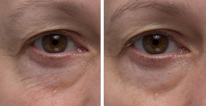 Dr. Denese SkinScience Firming Facial Collagen Eye Cream Face Moisturizer Hyaluronic Acid & Peptides Rejuvenate Skin - Improved Look of Fine Lines, Elasticity, Sagginess, Bags - Cruelty-Free - 1oz