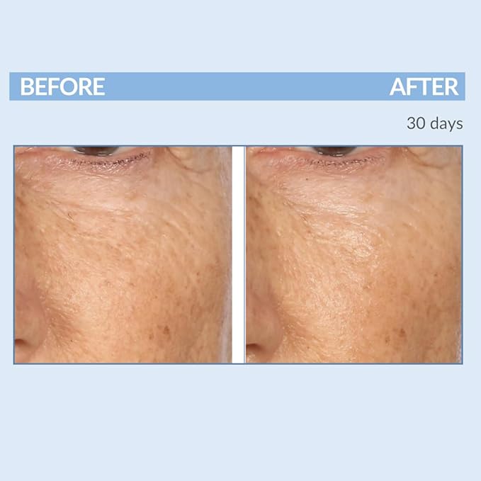 Serious Skincare - Retinol A Eye XR Under Eye Cream Concentrate - Reduce Fine Lines, Dark Circles & Puffiness - Daily Wrinkle Cream - Anti-Aging Skin Care Treatment for Women and Men - 0.5 oz