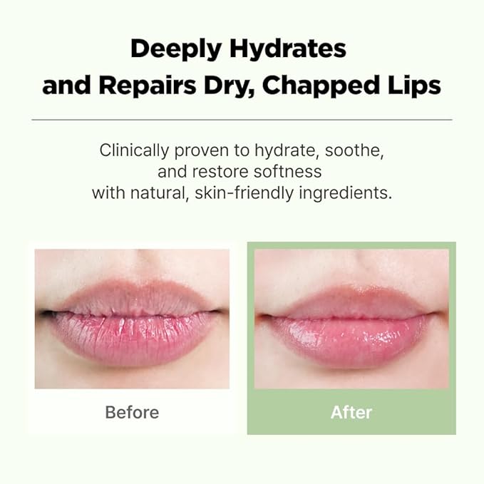CICAGO Cica Lip Balm, Daily Hydrating Lip Balm for Dry & Chapped Lips, Deep Moisture & Soothing Cica Care, Korean Skin Care (0.34 fl. oz, 10g)