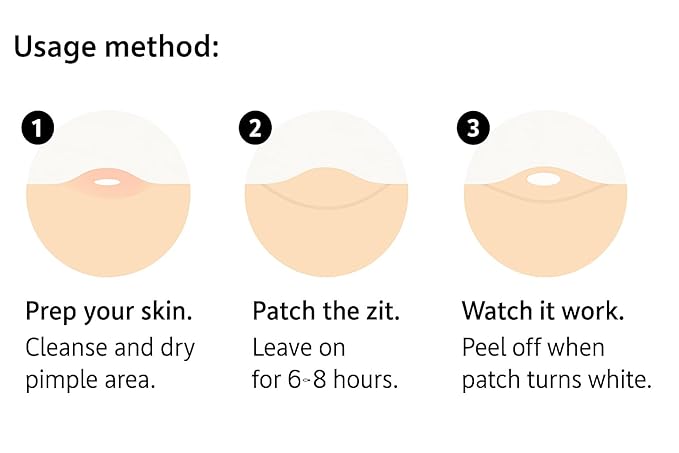 Hydrocolloid Acne Pimple Patch – 72 Count (9mm & 12mm) | Invisible Spot Patches for Pimples, Zits, Blemishes & Whiteheads | Fast Healing, Waterproof, Strong Adhesion & Gentle on Skin
