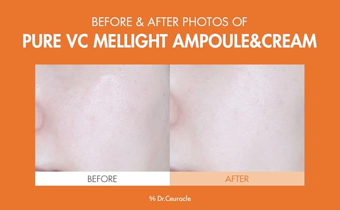 Dr.Ceuracle by leegeehaam Pure VC Mellight Ampoule - Vitamin C Serum for Face, One Week Program for Anti-oxidant, Firm, Clarify, Fade Pigmentation, Skin Radiance (1 Count (Pack of 1))