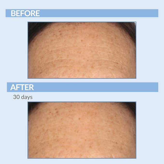 Serious Skincare Retinol Cream For Face - Vitamin A Cream XR Premium Moisturizer - Anti-Aging - Day & Night - Reduce Fine Lines & Wrinkles - For Radiant Skin 2 Fl. Oz.