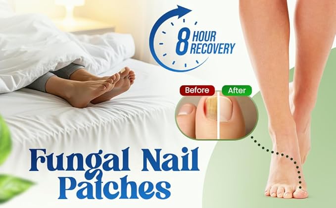 Premium Fungal Nail Patches Toe Nail Care Extra Fungus Strength 21 Pcs Nighttime Repair Damaged Treatment Toenail Discolored Nails 8 Hour Safe Sensitive gift for Valentine Day Women Men .(21 Count)
