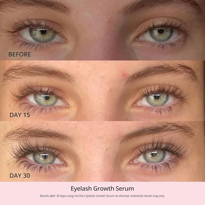 ForChics 24/7 Lash System - Growth Serum + Nourishing Mascara Bundle - Hormone-Free Day & Night Treatment for Longer, Thicker Lashes in 2 Weeks - Natural, Vegan [Duo]