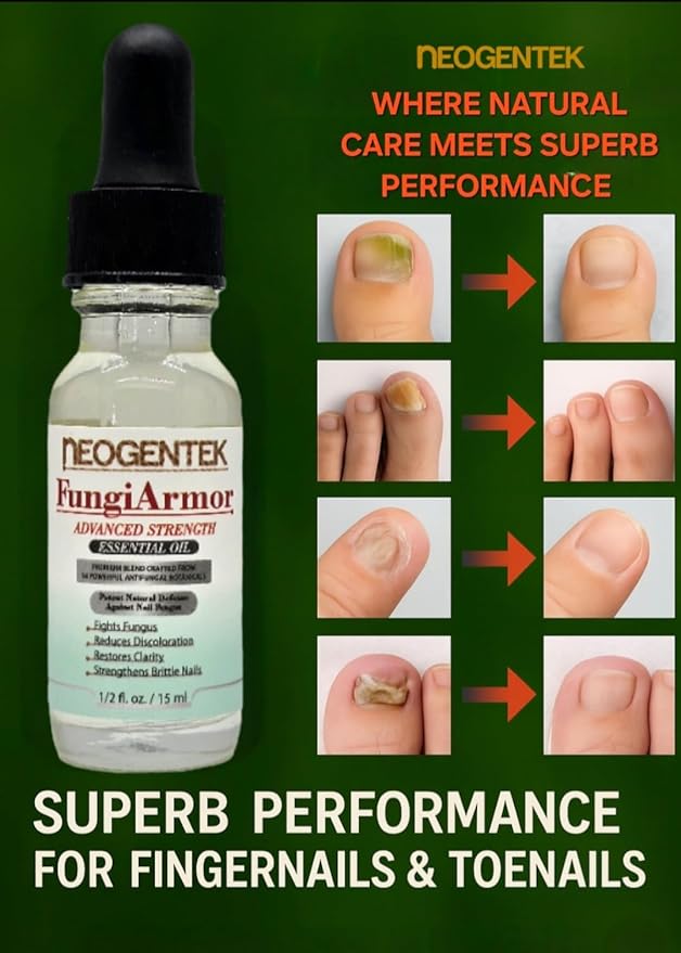 FungiAmor Fight Nail Fungus I Made From 14 Ultra-Powerful Botanical Oils I Ultra Strength | Promotes Healthy Nail | Renew | Restore Weak & Discolored Nails - Made in USA 15ML