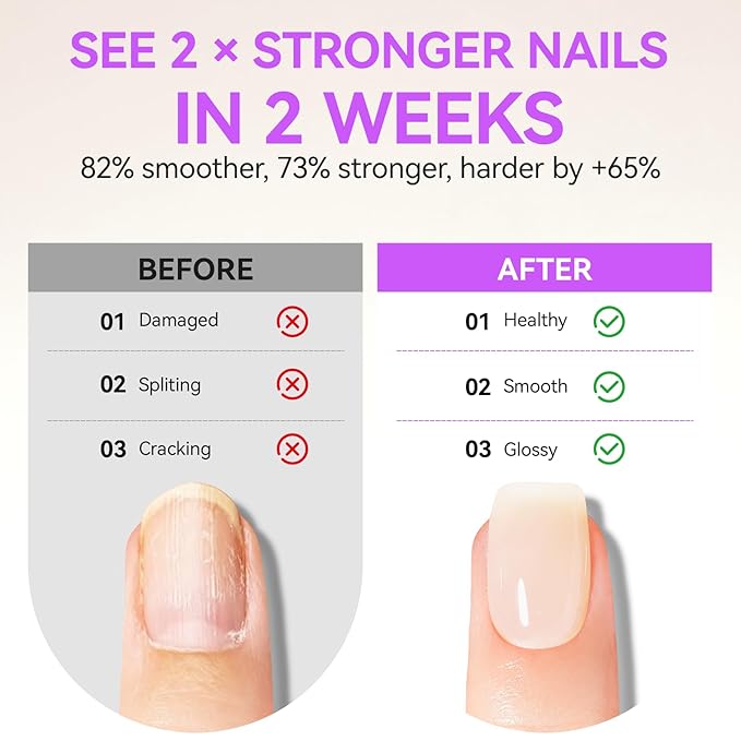 Gelike EC 2-in-1 Nail Rescue Kit: Apricot Nail Nail Growth Treatment & Pineapple Cuticle Oil (15ml) - Tropical Scented Nail Care - Strengthens & Brightens - Travel-Friendly Mini Size