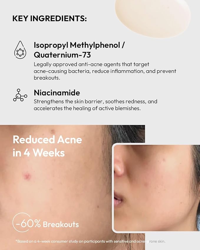 ACNO Anti-Acne Serum for Sensitive Skin - Gentle Blemish Treatment - Fragrance-Free & Non-Drying - 1 Fl Oz