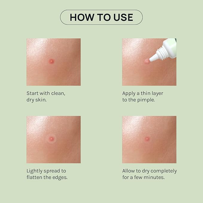 AOA Skin Invisible Acne Liquid Patch - Invisible Spot Treatment with Witch Hazel & Salicylic Acid, Liquid Pimple Patch, Clear Fits to Makeup | 0.42 Fl Oz, 12g