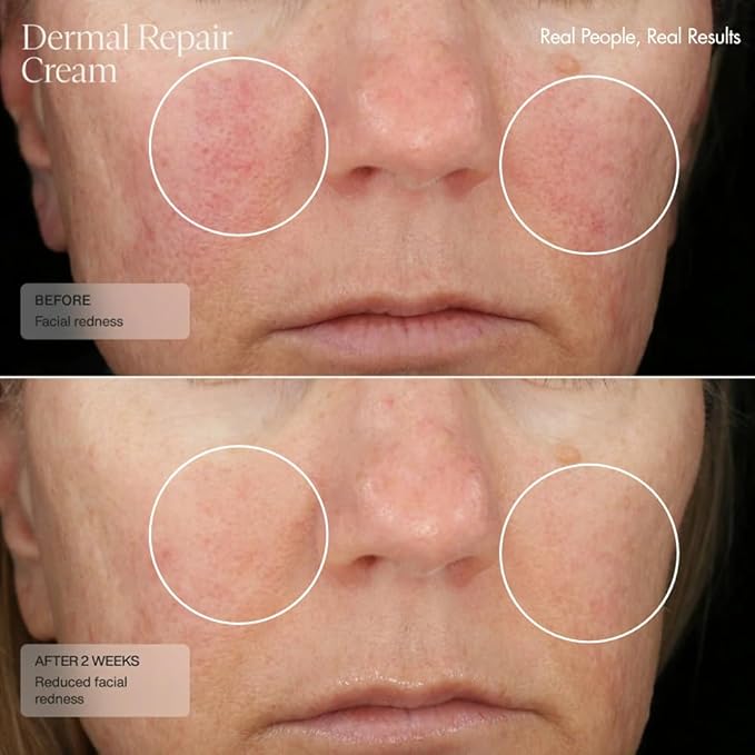 Senté The Repair Duo | Dermal Repair Ultra-Nourish & Bio Complete Serum | Complete Nighttime Skincare Set for Sensitive Skin | Helps Improve Tone, Texture & Hydration | 1.0 Fl Oz & 1.7 Fl Oz