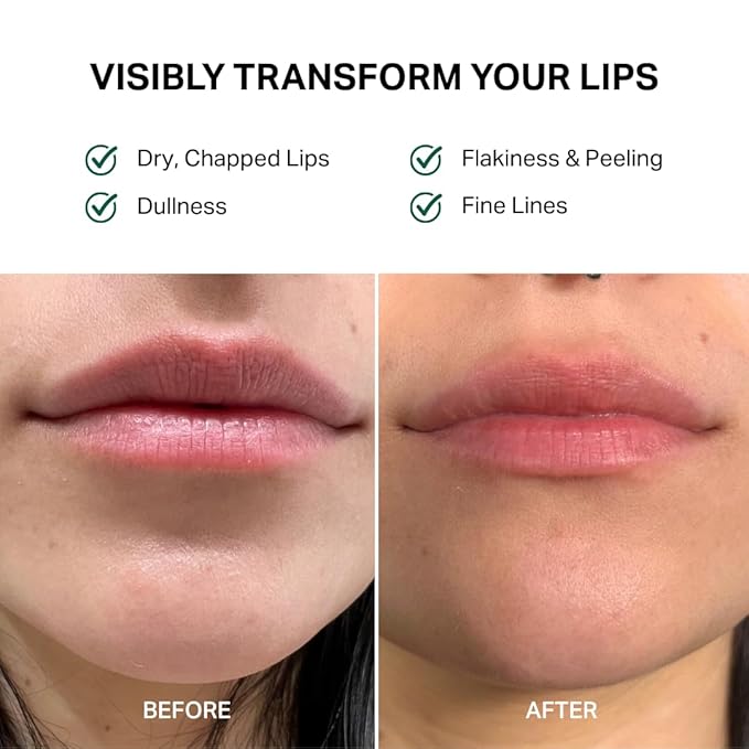 Y’OUR Intensive Lip Balm | Overnight Lip Mask: Lightweight & Comforting with Natural Shea Butter & Rosehip Oil; Extreme Moisturizer for Dry Lips. Paraben & Silicon-Free. Made in USA. 15ml (0.5 oz.)