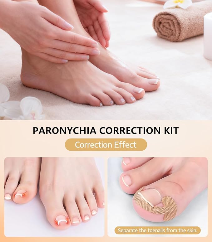 Ingrown Toenail Corrector Set with Correction Strips, Ingrown Toenail Removal Kit, Professional Ingrown Toenails Pedicure Tool Set, Curved Toenails Corrector Patch