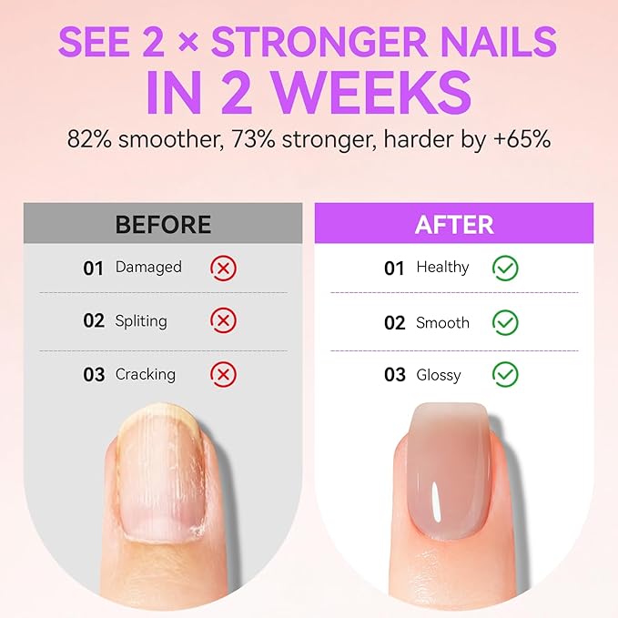 Gelike EC Professional Nail Care Kit: Nude Nail Growth Treatment & Watermelon Cuticle Oil (15ml) - Hydrating Protein Care for Dry Nails - Lightweight Non-Sticky - Perfect for Summer Manicures