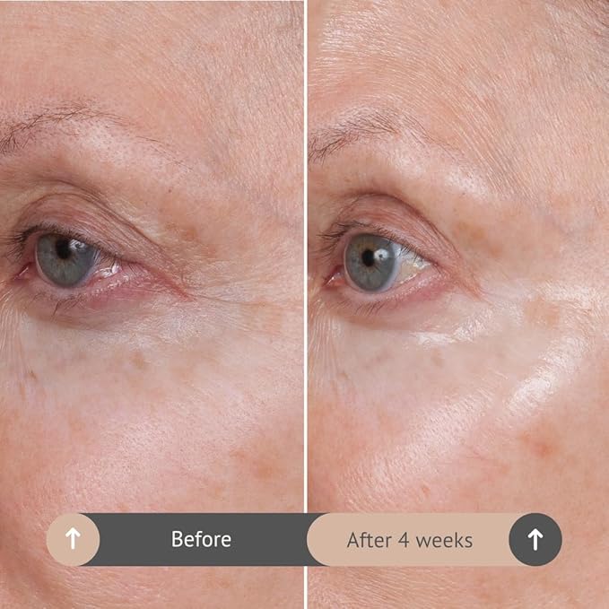 Consult Beaute Volumagen TRIO Skin Care For Plumper & Smoother Skin - Collagen, Hyaluronic Acid and Ceramides - Doctor Formulated for Face, Neck and Eyes - Boost Moisture for Glowing Complexion