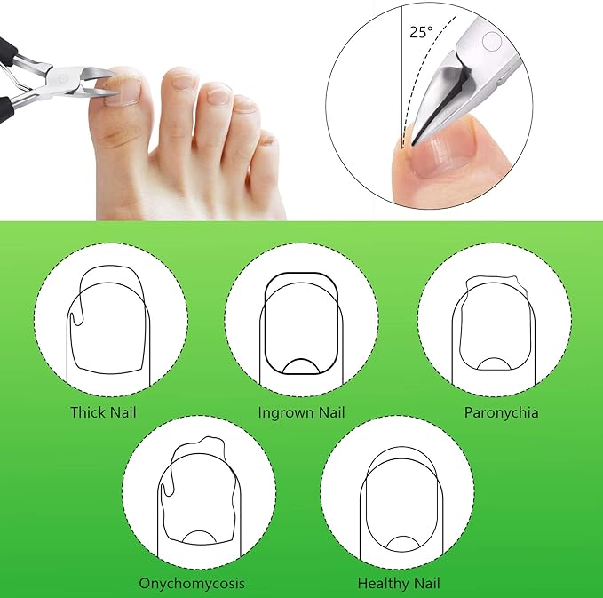 Feiccier Heavy Duty Ingrown Toenail Clippers, Professional Toenails Trimmer, Podiatrist Toe Nail Clippers for Thick Nail & Ingrown Toenails, Sharp Curved Blade, Pedicure Tools.
