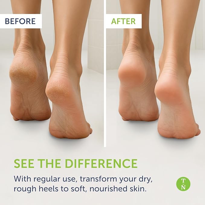 Truremedy Naturals Remedy Balm with Tea Tree Oil, 2 oz - Soothing Moisturizer for Rough Areas - Nourishing Foot and Body Balm with Tea Tree, Lavender, and Eucalyptus