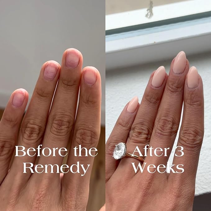 Botanist The Remedy | Nail Strengthening Polish | Repairs & Hardens Nails Damaged from Acrylics, Dip & Gel Manicures | Non-Toxic, 84% Plant Based, 21-Free & Vegan (Blush Dahlia)