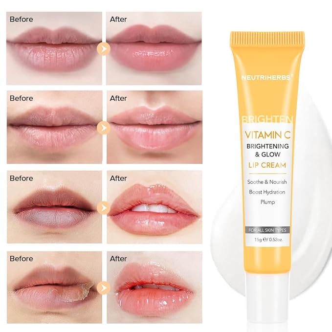 NEUTRIHERBS Lip Cream, Vitamin C Lip Balm to Nourish and Soothes Dry, Cracked Lips,Repair Chapped Lips with Squalane, Portable Lip Treatment - 0.52oz