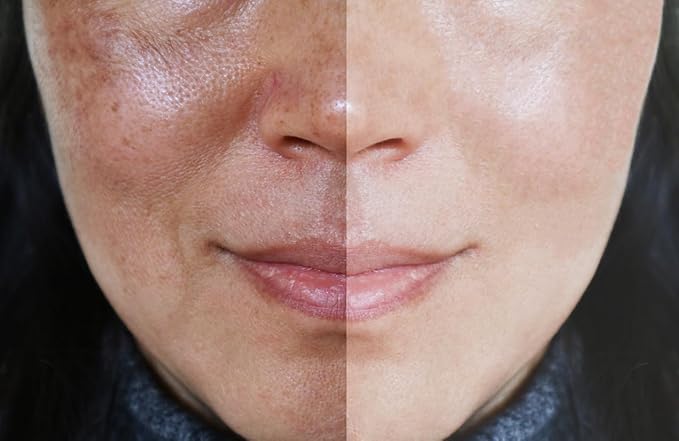 Vitality Precision Skin Phloretin C Serum