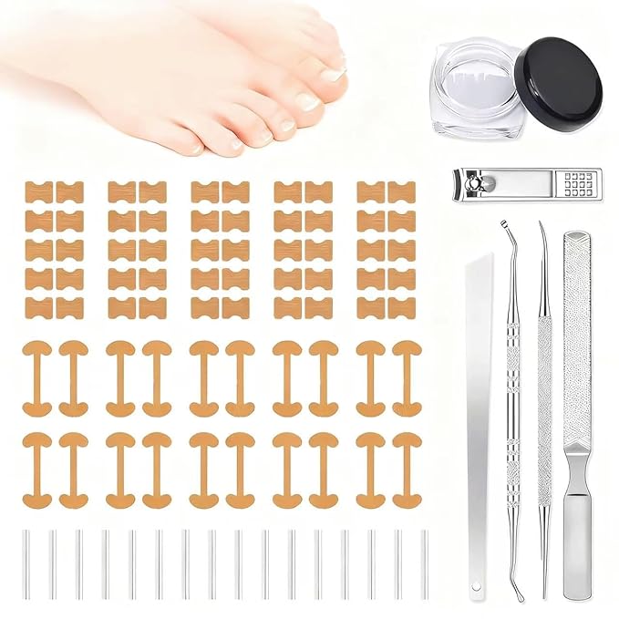 Ingrown toenail removal kit (Type A): Contains corrector, breathable/curved corrector strips, painless file, nail remover and pedicure tools, suitable for both men and women.