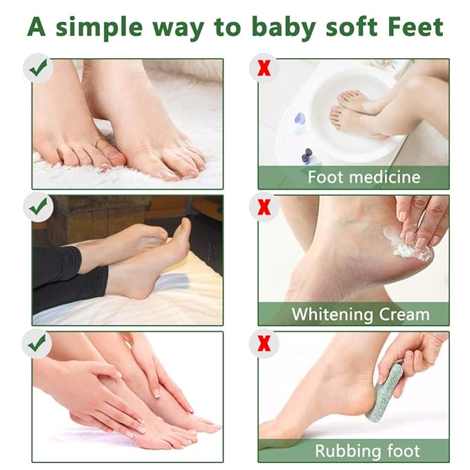 Liefiet Foot Peeling Mask 5 Pack, Foot Mask Remove Dead Skin, Rough Callus and Cracked Heels, Dry Skin Moisturizer for Soft and Smooth Baby Touch Feet (Tea Tree)