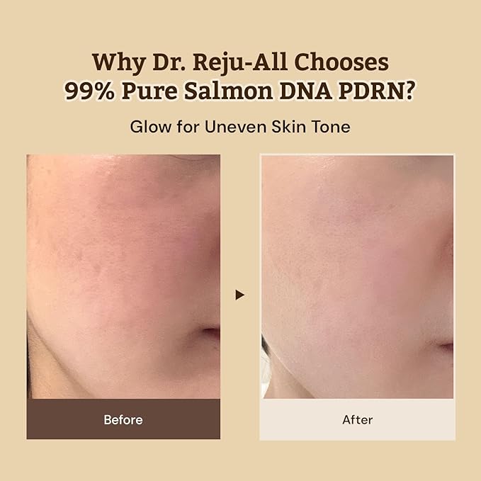 Repair & Tone Duo: Advanced PDRN Rejuvenating Cream + Advanced Retino-Mela Serum - Face Moisturizer & Retinol Serum for Firming & Smooth Skin, Korean Pharmacy Anti-Aging Skin Care